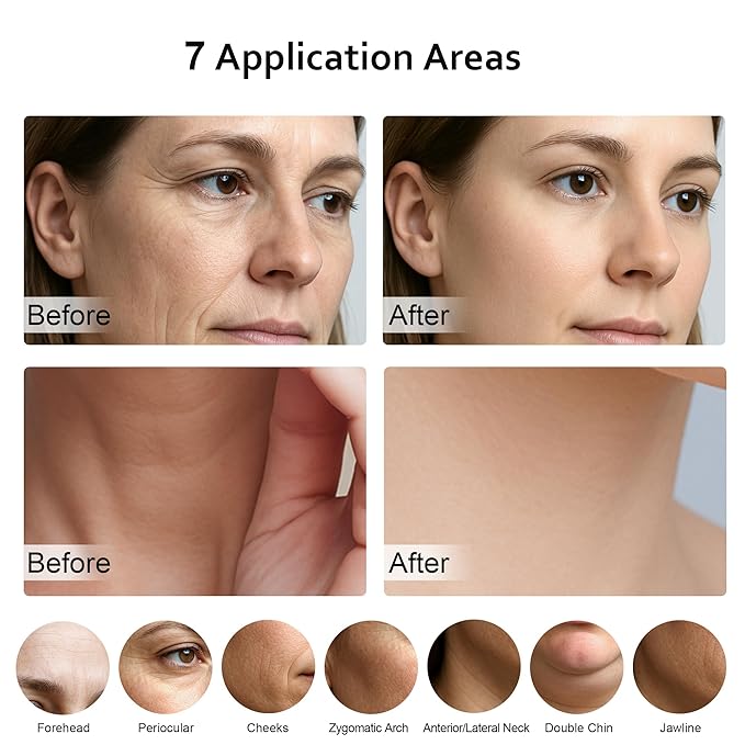 5-in-1 Multifunctional Facial Massager, Beauty Skin Care Tool for Face and Neck, Portable Face Massager Tool-Rose Model