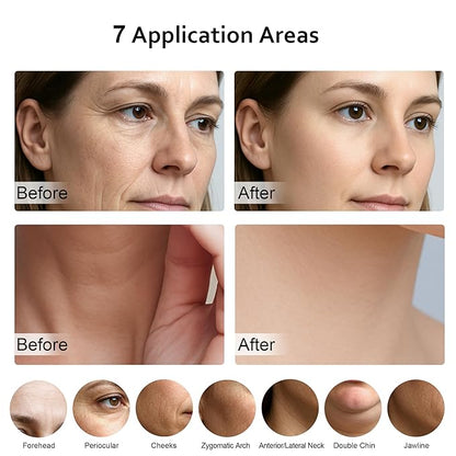 5-in-1 Multifunctional Facial Massager, Beauty Skin Care Tool for Face and Neck, Portable Face Massager Tool-Rose Model